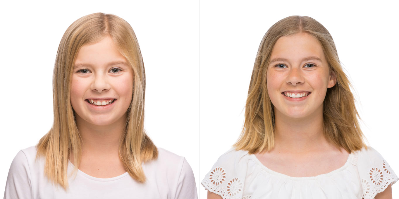 teen-vorher-nachher-6